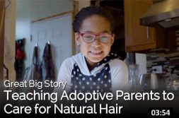 Adoption | Hair